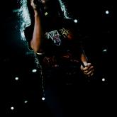Anthrax pic